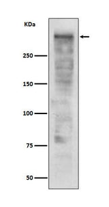 Anti-Ki67 MKI67 Rabbit Monoclonal Antibody Boster Bio