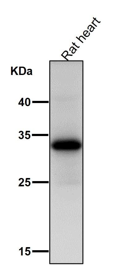 Anti-UCP1+UCP3 Rabbit Monoclonal Antibody Boster Bio