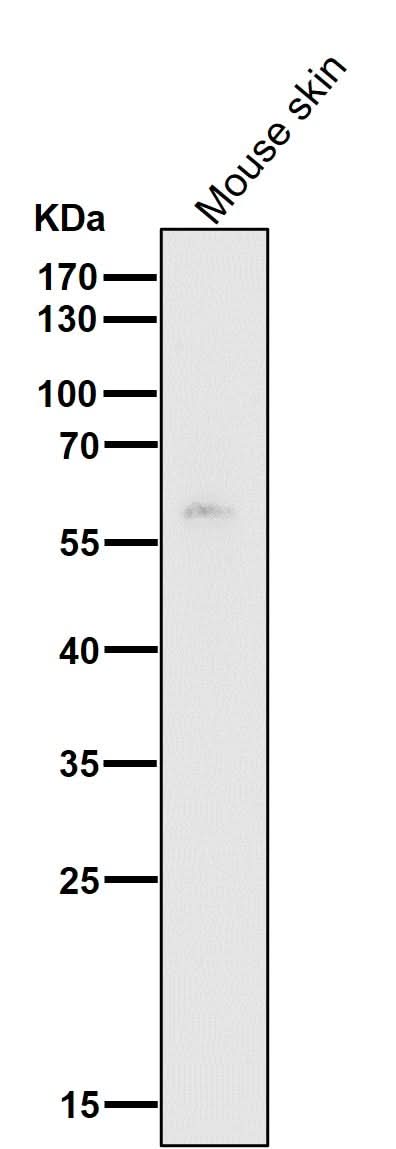 Anti-HDAC1 Rabbit Monoclonal Antibody Boster Bio