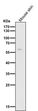 Anti-HDAC1 Rabbit Monoclonal Antibody Boster Bio