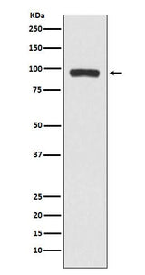 Anti-BCHE Rabbit Monoclonal Antibody Boster Bio