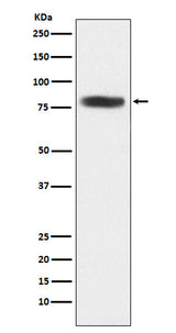 Anti-CARS Rabbit Monoclonal Antibody Boster Bio