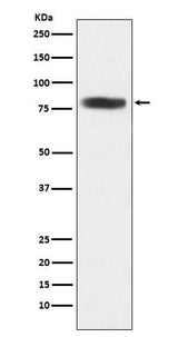 Anti-CARS Rabbit Monoclonal Antibody Boster Bio
