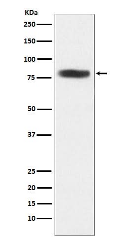Anti-CARS Rabbit Monoclonal Antibody Boster Bio
