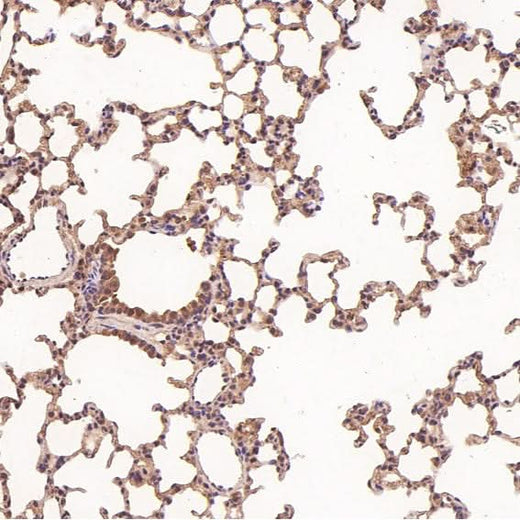 Anti-NAK/TBK1 (N-term) Rabbit Monoclonal Antibody Boster Bio