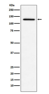 Anti-MDA5 Monoclonal Antibody Boster Bio