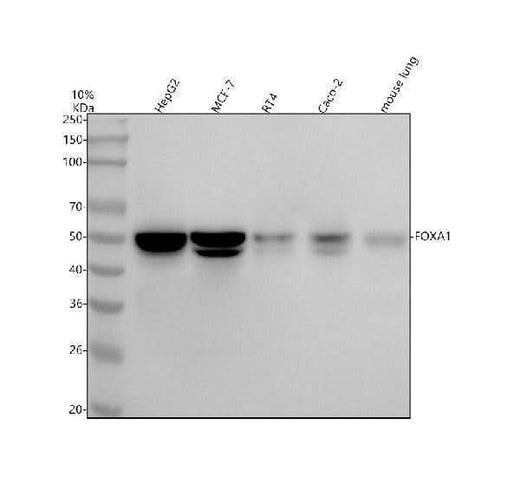 Anti-FOXA1/Hnf 3 Alpha Rabbit Monoclonal Antibody Boster Bio