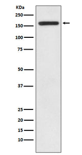 Anti-IRS1 Rabbit Monoclonal Antibody Boster Bio