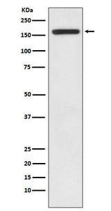 Anti-IRS1 Rabbit Monoclonal Antibody Boster Bio