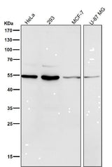 Anti-MiTF Rabbit Monoclonal Antibody Boster Bio
