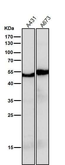 Anti-PAX6 Rabbit Monoclonal Antibody Boster Bio