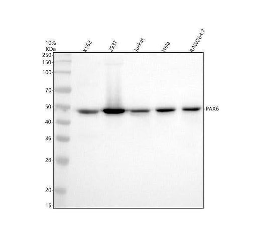 Anti-PAX6 Rabbit Monoclonal Antibody Boster Bio