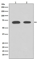 Anti-Chk2 CHEK2 Rabbit Monoclonal Antibody Boster Bio