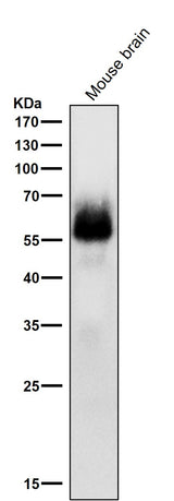 Anti-Phospho-Chk2 (S33 + S35) Rabbit Monoclonal Antibody Boster Bio