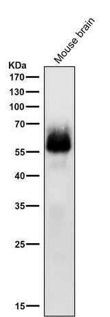 Anti-Phospho-Chk2 (S33 + S35) Rabbit Monoclonal Antibody Boster Bio