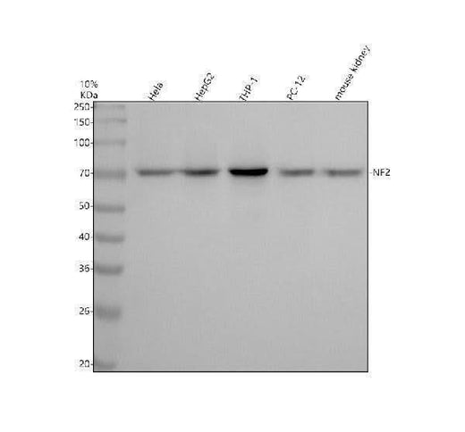 Anti-NF2 / Merlin Monoclonal Antibody Boster Bio