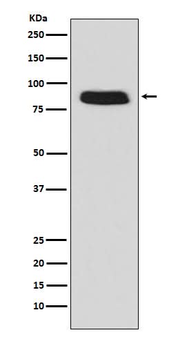 Anti-GCSF Receptor (CD114) Monoclonal Antibody Boster Bio