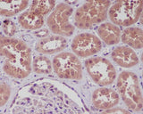 Anti-NF-Kappa B (p105/p50) NFKB1 Rabbit Monoclonal Antibody Boster Bio