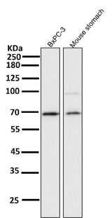 Anti-NF-Kappa B p65 RELA Rabbit Monoclonal Antibody Boster Bio
