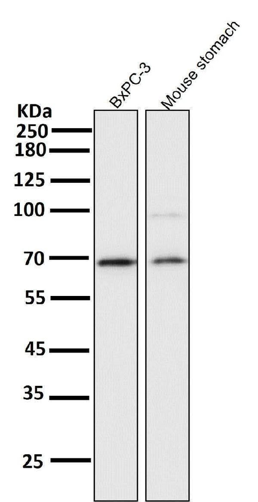 Anti-NF-Kappa B p65 RELA Rabbit Monoclonal Antibody Boster Bio