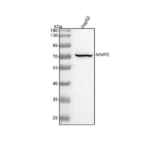 Anti-MMP2 Rabbit Monoclonal Antibody Boster Bio
