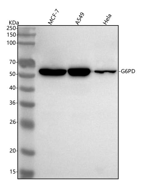 Anti-G6PD/Glucose 6 Phosphate Dehydrogenase Rabbit Monoclonal Antibody Boster Bio
