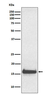 Anti-TTR/Prealbumin Rabbit Monoclonal Antibody Boster Bio