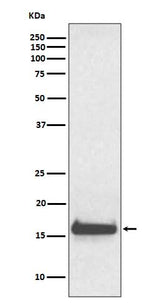 Anti-TTR/Prealbumin Rabbit Monoclonal Antibody Boster Bio