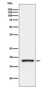 Anti-Prealbumin TTR Rabbit Monoclonal Antibody Boster Bio