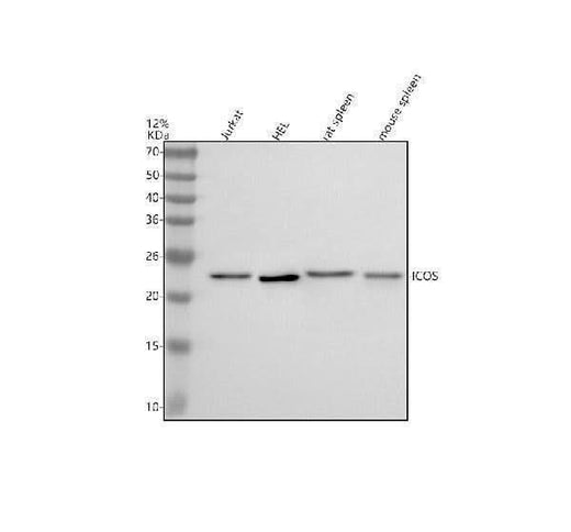 Anti-ICOS Rabbit Monoclonal Antibody Boster Bio