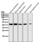 Anti-MEK1 MAP2K1 Rabbit Monoclonal Antibody Boster Bio