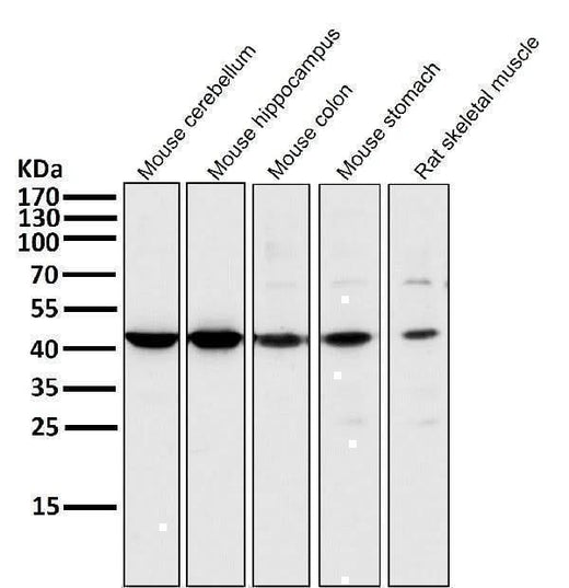 Anti-MEK1 MAP2K1 Rabbit Monoclonal Antibody Boster Bio