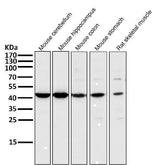 Anti-MEK1 MAP2K1 Rabbit Monoclonal Antibody Boster Bio