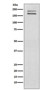 Anti-Ret Rabbit Monoclonal Antibody Boster Bio