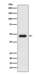 Anti-CXCR3 Monoclonal Antibody Boster Bio