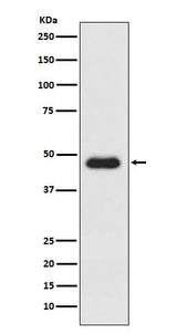 Anti-CXCR3 Monoclonal Antibody Boster Bio
