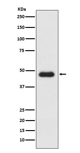 Anti-CXCR3 Monoclonal Antibody Boster Bio