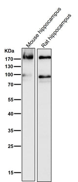 Anti-ErbB4/Her4 Rabbit Monoclonal Antibody Boster Bio