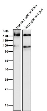 Anti-ErbB4/Her4 Rabbit Monoclonal Antibody Boster Bio