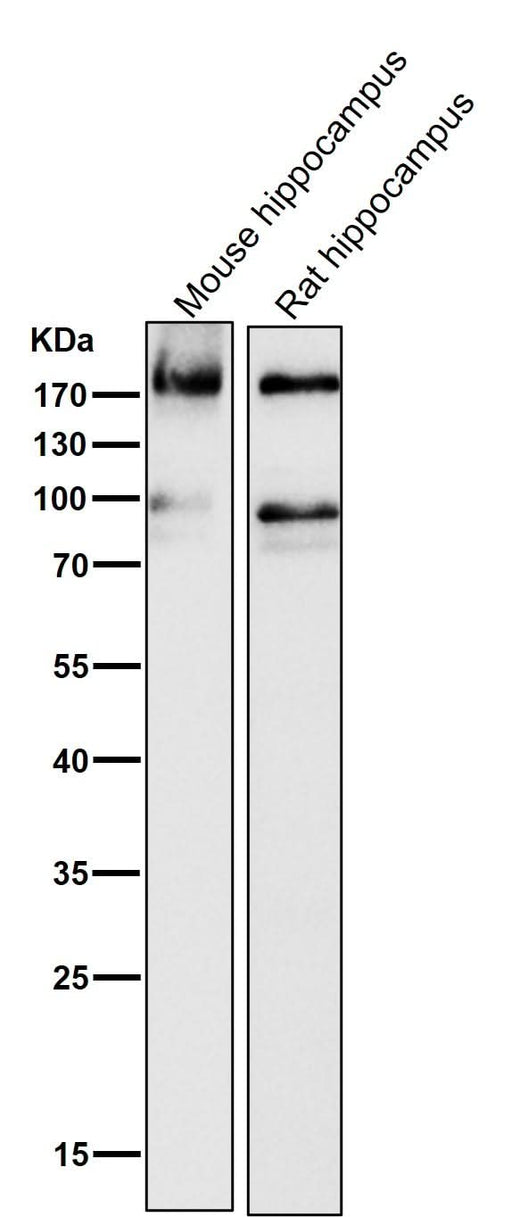 Anti-ErbB4/Her4 Rabbit Monoclonal Antibody Boster Bio