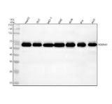 Anti-SQSTM1 / p62 Rabbit Monoclonal Antibody Boster Bio