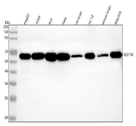 Anti-p62/SQSTM1 Rabbit Monoclonal Antibody Boster Bio