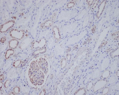 Anti-ALK Rabbit Monoclonal Antibody Boster Bio