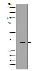 Anti-TBP/Tata Binding Protein Tbp Rabbit Monoclonal Antibody Boster Bio