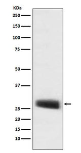 Anti-POMC Monoclonal Antibody Boster Bio