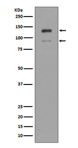 Anti-IFNAR1/Beta R1 Rabbit Monoclonal Antibody Boster Bio
