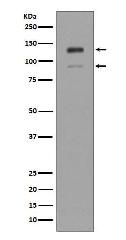 Anti-IFNAR1/Beta R1 Rabbit Monoclonal Antibody Boster Bio