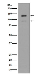 Anti-IFNAR1/Beta R1 Rabbit Monoclonal Antibody Boster Bio