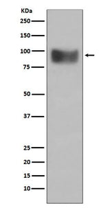 Anti-Interferon Receptor alpha IFNAR1 Rabbit Monoclonal Antibody Boster Bio