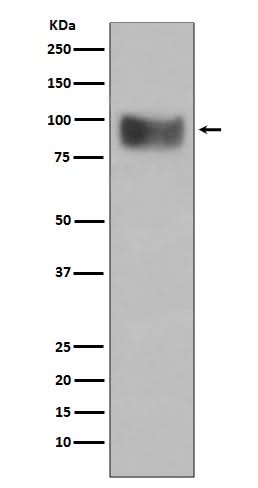 Anti-Interferon Receptor alpha IFNAR1 Rabbit Monoclonal Antibody Boster Bio